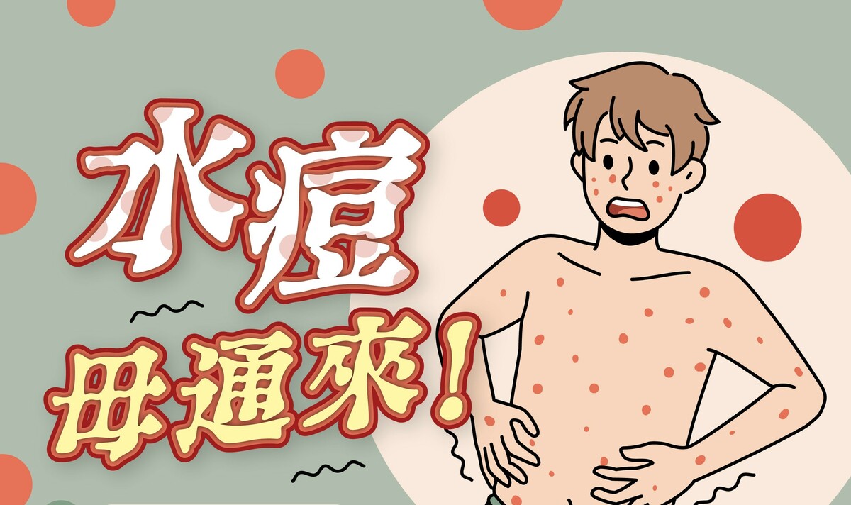 勤洗手及注意咳嗽禮節,避免水痘上身。 圖:高雄市衛生局/提供